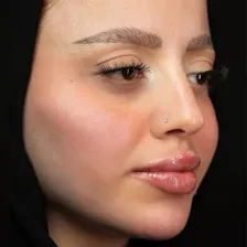 کلینیک زیبایی و لیزر ماه سیما