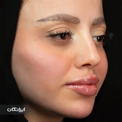 کلینیک زیبایی و لیزر ماه سیما