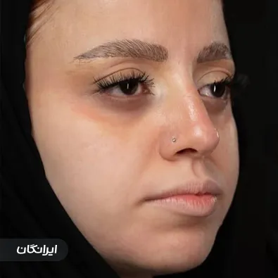 کلینیک زیبایی و لیزر ماه سیما