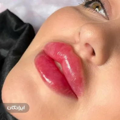 کلینیک زیبایی تهامی