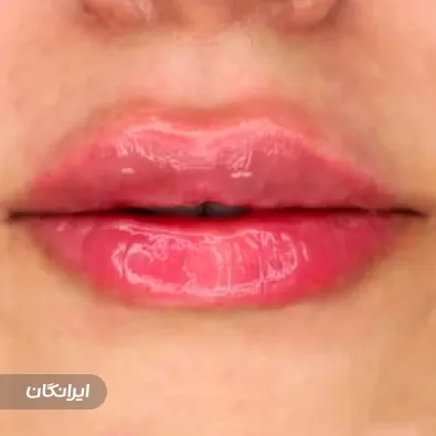 کلینیک زیبایی دکتر مسعود احمدزاده