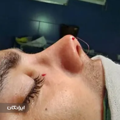 کلینیک زیبایی آرتین