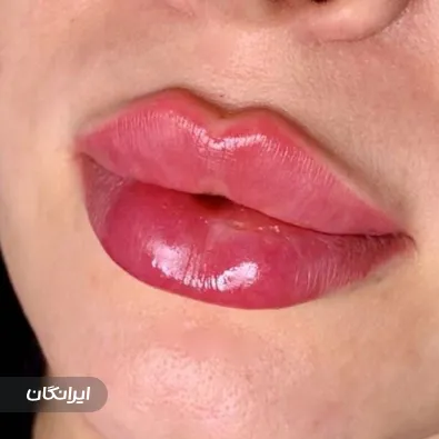 کلینیک زیبایی ایرانا