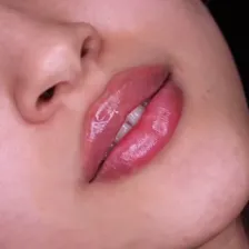 کلینیک زیبایی خورشید غرب