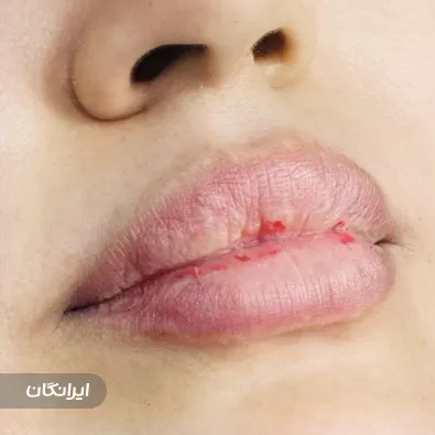 کلینیک زیبایی دایان