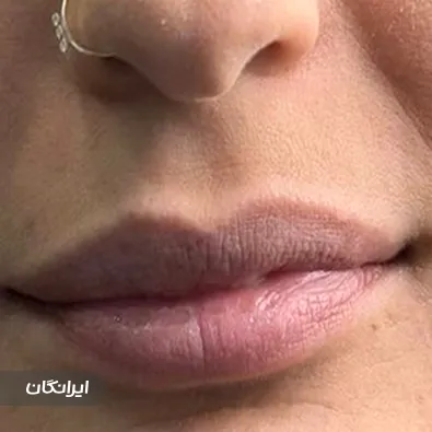 کلینیک زیبایی اریکا