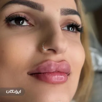 کلینیک زیبایی اریکا