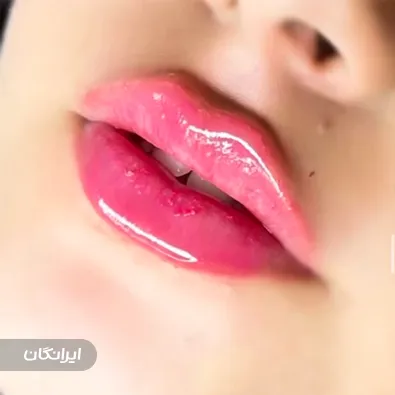 کلینیک زیبایی دنیز