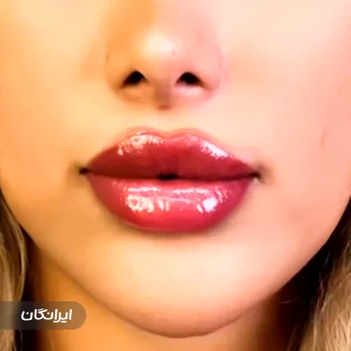 کلینیک زیبایی دنیز