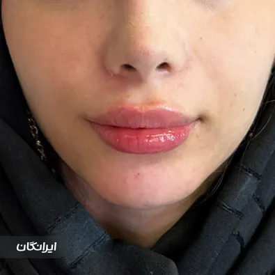 کلینیک زیبایی لوتوسا