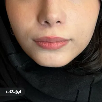 کلینیک زیبایی لوتوسا