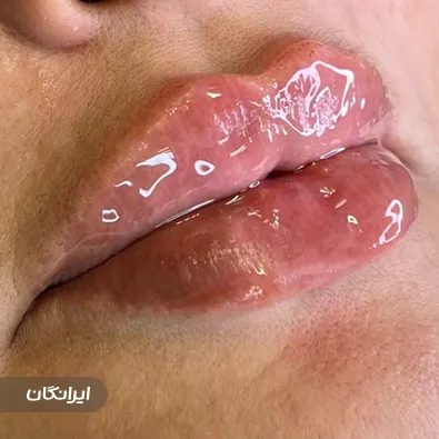 کلینیک زیبایی لوتوسا