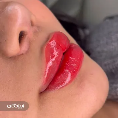 کلینیک زیبایی گلشن