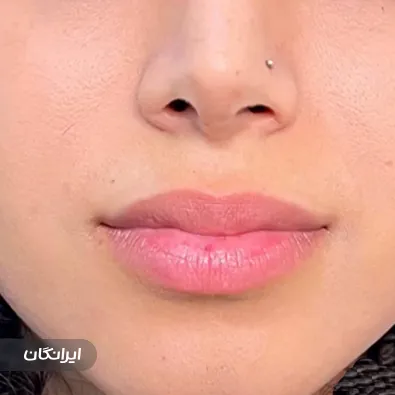 کلینیک زیبایی دکتر محسن پورآریا