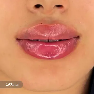 کلینیک زیبایی دکتر محسن پورآریا