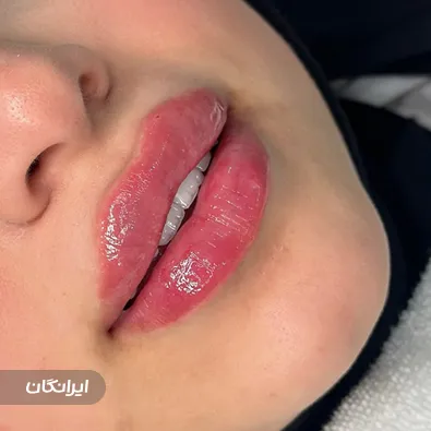 کلینیک زیبایی بوژان