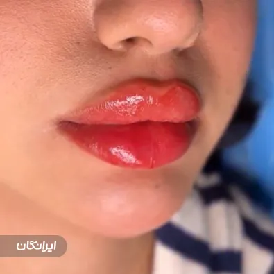 کلینیک زیبایی بوژان