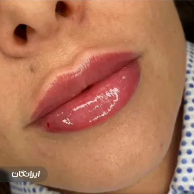 کلینیک زیبایی بوژان