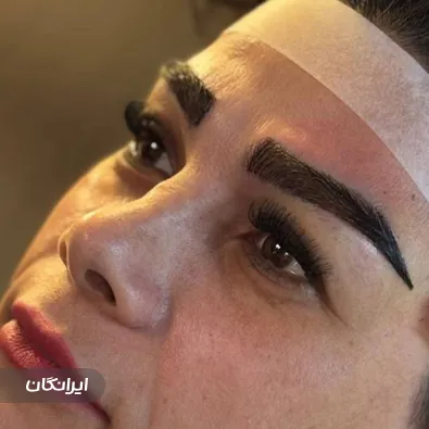 کلینیک زیبا کاشت