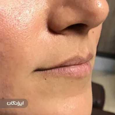 کلینیک زیبایی روشا