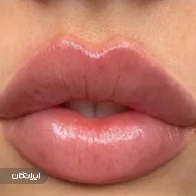 کلینیک زیبایی روشا