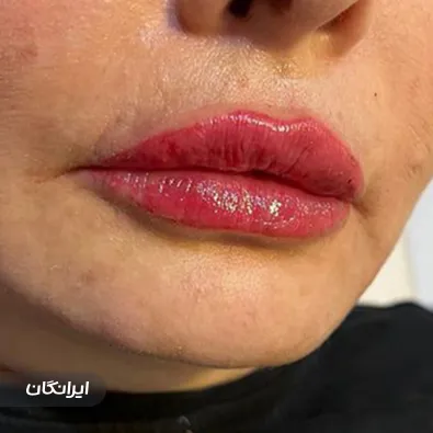 کلینیک زیبایی دکتر آرزو مرزنگ