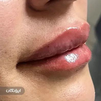 کلینیک زیبایی دکتر آرزو مرزنگ