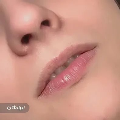 کلینیک زیبایی دکتر توحیده جهان دیده