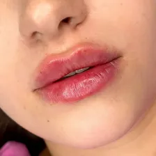 کلینیک زیبایی دکتر سپیده تیزآبی