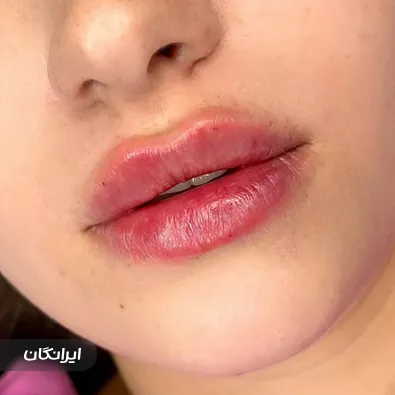 کلینیک زیبایی دکتر سپیده تیزآبی