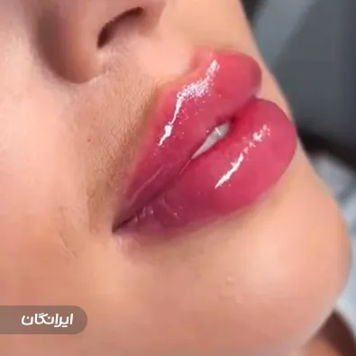 کلینیک زیبایی دکتر سپیده تیزآبی