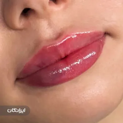 کلینیک زیبایی دکتر سپیده تیزآبی