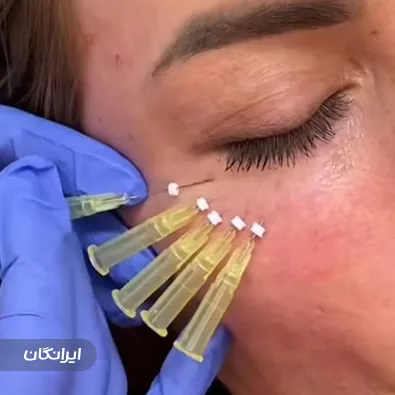 کلینیک زیبایی ملورین