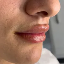 کلینیک زیبایی نوژا