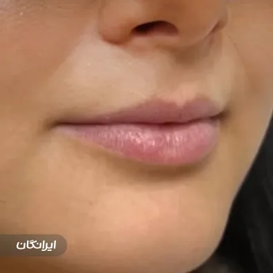 کلینیک زیبایی نوژا