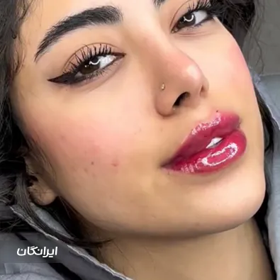 کلینیک زیبایی ایران درما