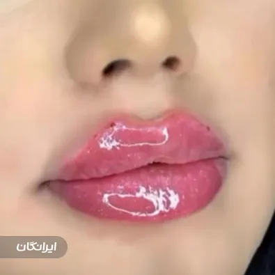 کلینیک زیبایی دنیز