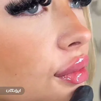 کلینیک زیبایی دلانا