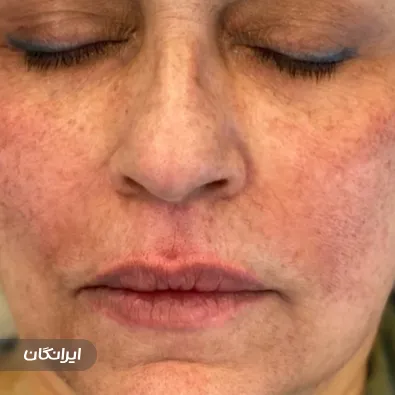 کلینیک زیبایی دکتر رامین عالینژاد