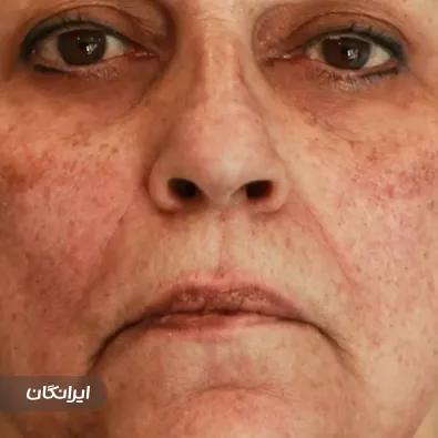 کلینیک زیبایی دکتر رامین عالینژاد