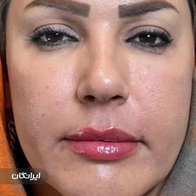 کلینیک زیبایی دکتر بهادر حسن زاده