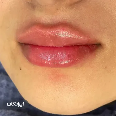 کلینیک زیبایی نیتا