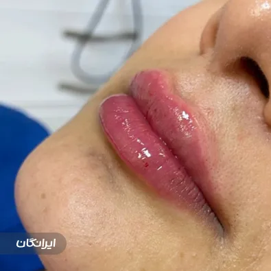 کلینیک زیبایی نیتا