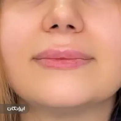 کلینیک زیبایی آلبارز