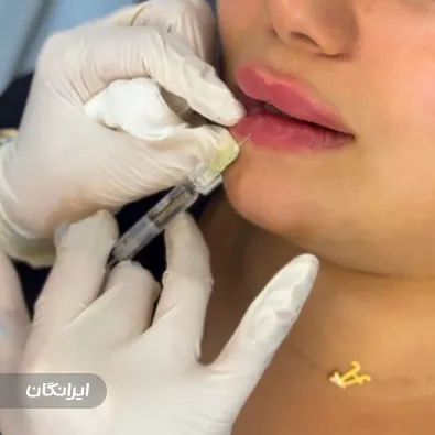 کلینیک زیبایی آلبارز