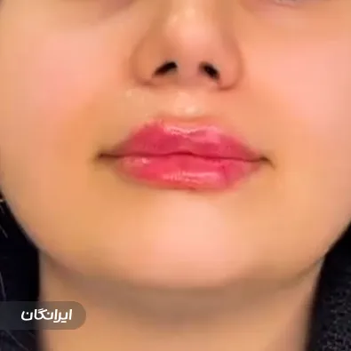 کلینیک زیبایی آلبارز