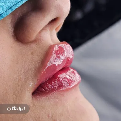 کلینیک زیبایی حریال