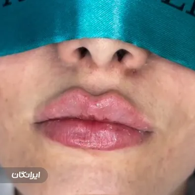 کلینیک زیبایی حریال