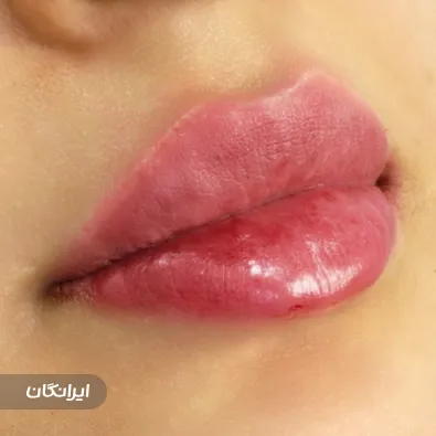 کلینیک زیبایی دکتر طیبه یوسف زاد