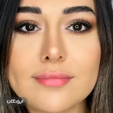 کلینیک زیبایی دکتر طیبه یوسف زاد